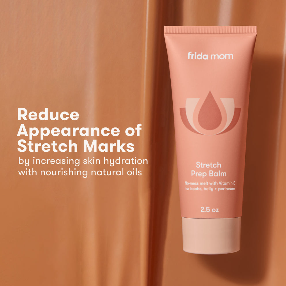 Stretch Prep Balm for Stretch Marks \u0026 Perineum - 2.5 oz
